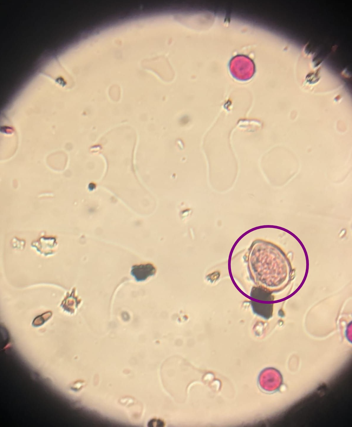 Esporanxio Plasmopara