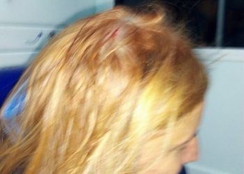 Una peñista de Sempre co Celta acaba en el hospital por la caída de un cascote en Balaídos