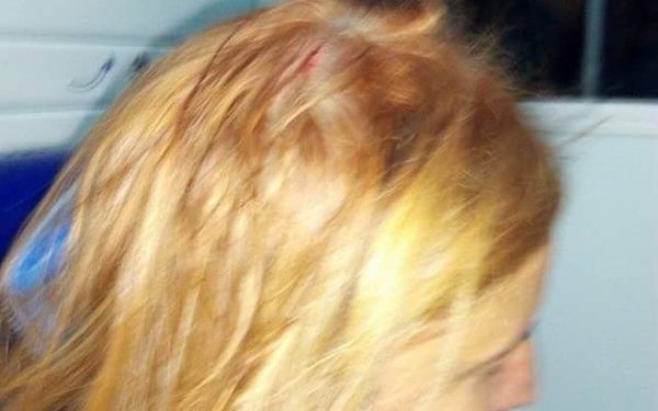 Una peñista de Sempre co Celta acaba en el hospital por la caída de un cascote en Balaídos