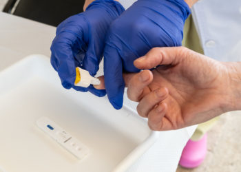 O estudo epidemiolóxico galego sobre o Covid-19 involucra a 18 centros de saúde de Vigo