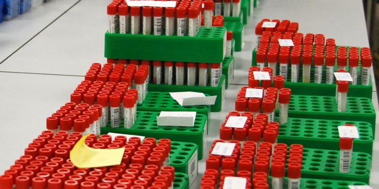 El área sanitaria de Vigo roza los mil casos activos de Covid-19 tras sufrir otro pico de contagios: 113 en 24 horas