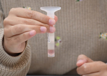 A Universidade de Vigo inicia as probas PCR a máis de 2.800  persoas